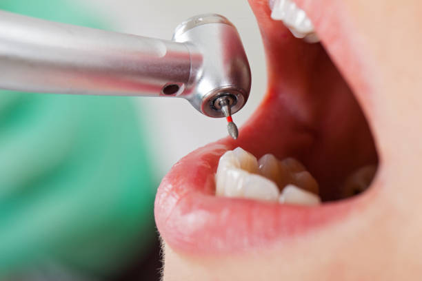 Best Emergency Broken Tooth Repair in Lynn Haven, FL